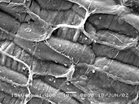 Middle aged viable root of Cryptocoryne at 1000 X magnification.